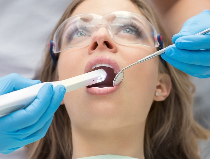 Caméra intra-orale Caméra intra-orale