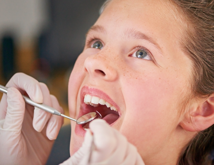 Déroulement de l’application du scellant dentaire Déroulement de l’application du scellant dentaire