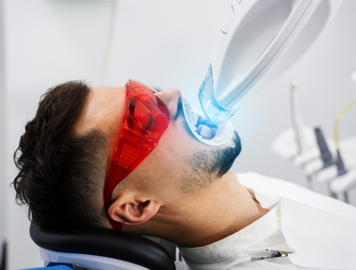 Déroulement d’un traitement de blanchiment Déroulement d’un traitement de blanchiment