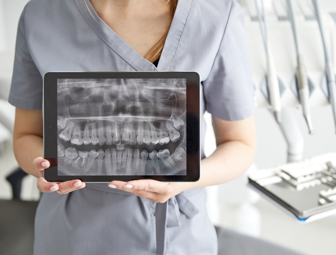 Le rôle de l’examen et du nettoyage dans la santé buccodentaire