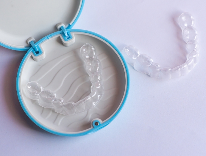 Une approche discrète pour améliorer l’alignement dentaire Une approche discrète pour améliorer l’alignement dentaire