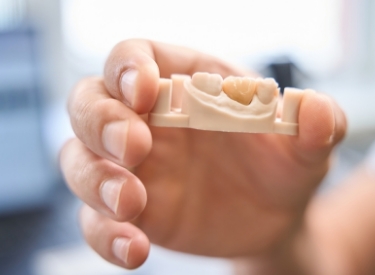 Couronne et pont Couronne et pont